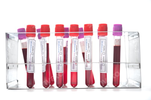 Preview: coronavirus COVID-19 sample blood test in test-tube, isolated on white background
