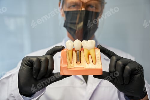 Preview: Serious dentist showing a teeth model with implant to camera