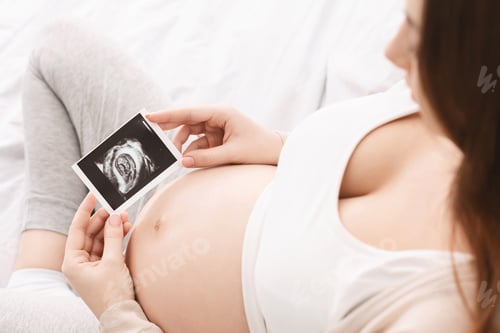 Preview: Pregnant woman enjoying her baby ultrasound image