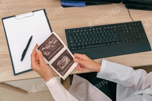 Preview: Woman doctor holds the results of an ultrasound examination in her hands in hospital