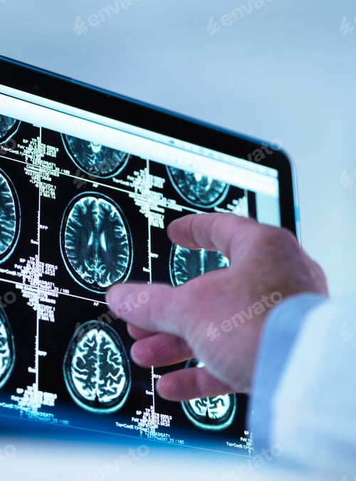 Preview: Doctor viewing a series of MRI (Magnetic Resonance Imaging) brain scans on a screen