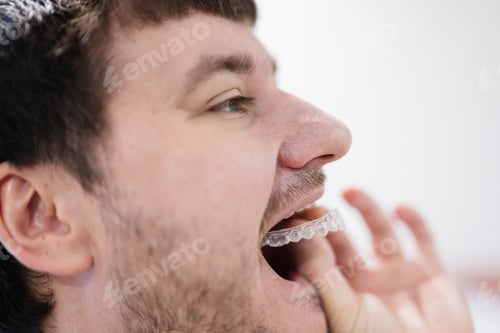 Preview: Man wearing orthodontic silicone trainer or invisible braces aligner.
