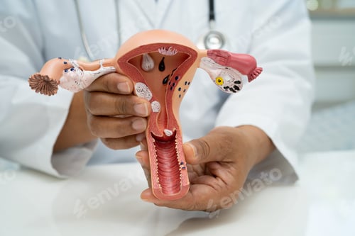 Preview: Uterus, doctor with anatomy model for study diagnosis and treatment in hospital.