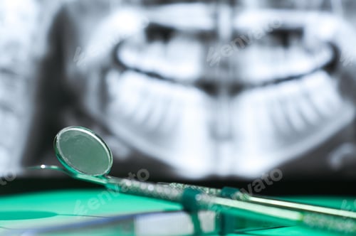 Preview: Professional dental tools in a clinic
