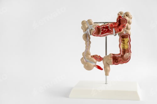 Preview: Human colon model on light background. Space for text