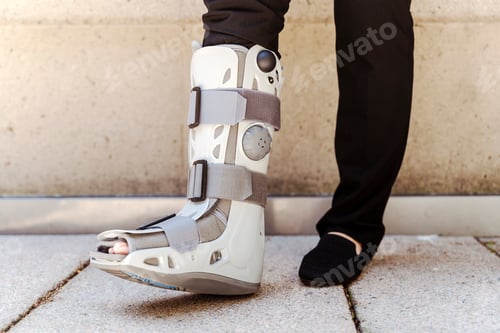 Preview: Businesswoman wearing an orthopedic boot standing on the street