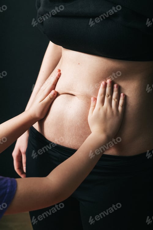 Preview: Close-up of female showing stretch marks. Women body after childbirth. Body recovery and care.