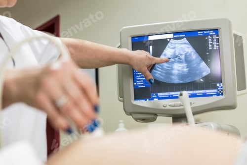 Preview: In the Hospital, Close-up Shot of the Doctor does Ultrasound Sonogram Procedure to a Pregnant Woman