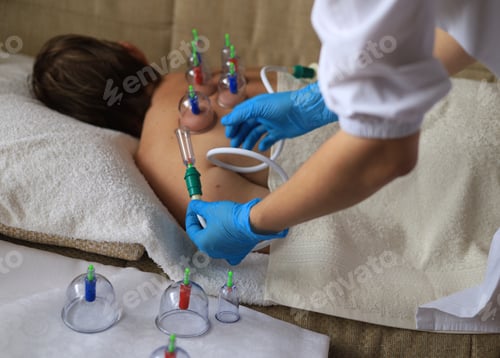 Preview: A doctor treats women's health a woman about 60 years old with Chinese vacuum massage jars