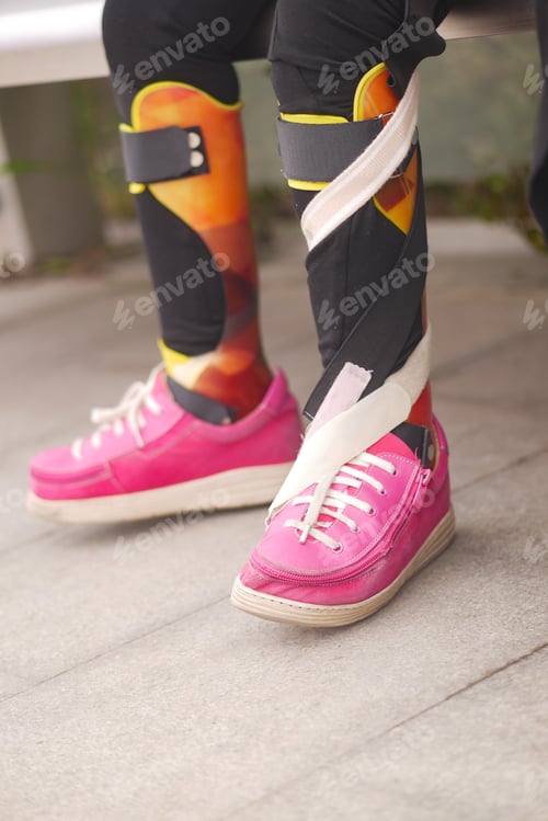 Preview: Innovative leg braces paired with colorful sporty shoes