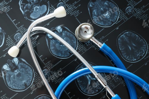 Preview: MRI or magnetic resonance imaging of the head and brain with a stethoscope. Close up