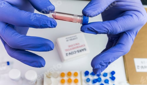 Preview: Scientist examines sample of coronavirus in laboratory, conceptual image