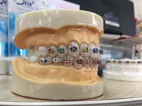 Preview: Dentist Teeth model