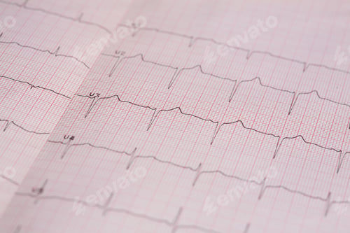 Preview: Close-up of the Electroencephalogram graph on a pink paper