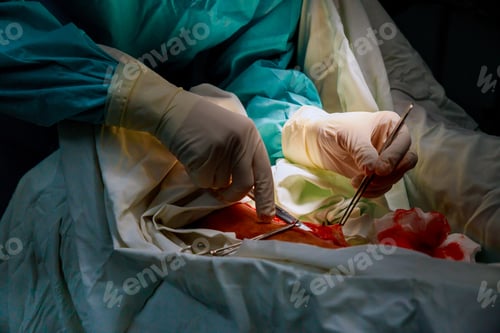 Preview: Surgery in Progress with Gloved Hands and Tools