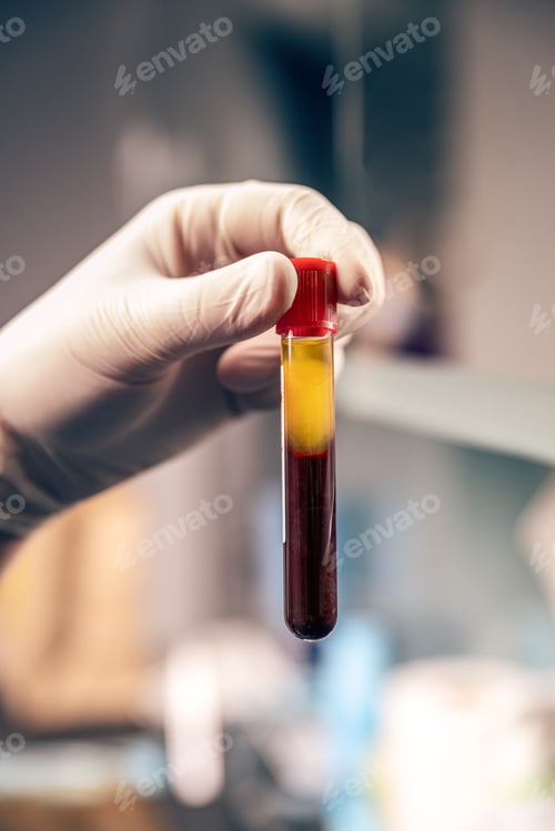 Preview: Extraction of plasma from blood
