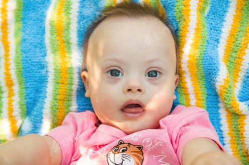 Preview: Cute baby boy with Down syndrome lying on blanket in summer day on nature
