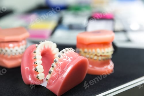 Preview: Dental or orthodontic tools, denture closeup
