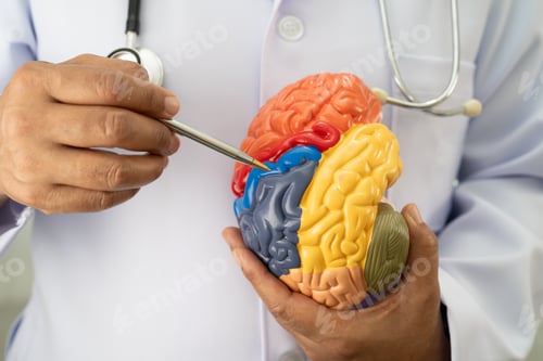Preview: Alzheimer disease, Asian doctor holding brain anatomy model