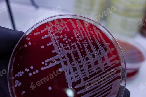 Preview: Bacterial colonies on red agar plate in a laboratory