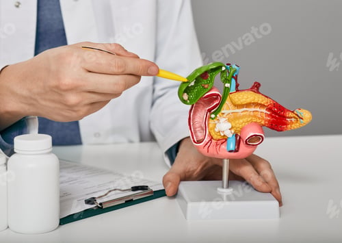 Preview: Treatment of gallbladder diseases and cholelithiasis. Doctor demonstrations gallbladder on