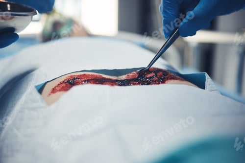 Preview: Wound surgery, hand and patient operation, hospital emergency or doctor healing client anatomy, bod