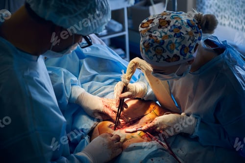 Preview: Surgeons Performing Operation in Hospital Setting