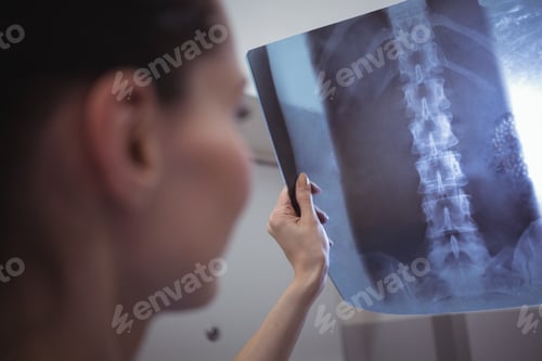 Preview: Female nurse examining x-ray report