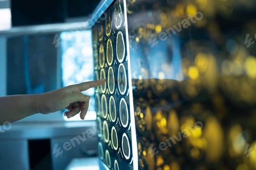 Preview: doctors looking at some lab results on monitors, in an office at the hospital.