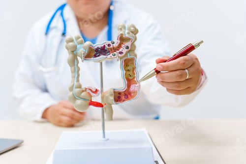 Preview: A doctor holds a human colon anatomy model, demonstrating the digestive system