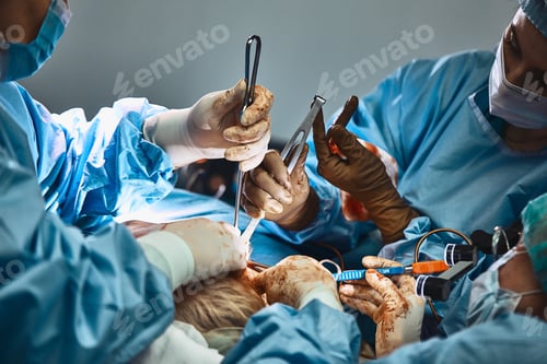 Preview: Operation contour facelift. A real operation, a team of surgeons performs an operation on the nose