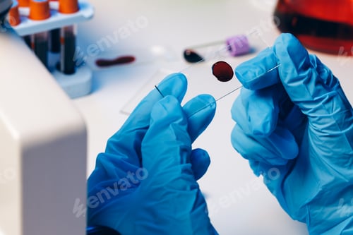 Preview: Hands of a laboratory worker doing blood test