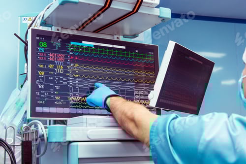Preview: Male anaesthesiologist hand pointing vital activity data at modern monitor system in operation room