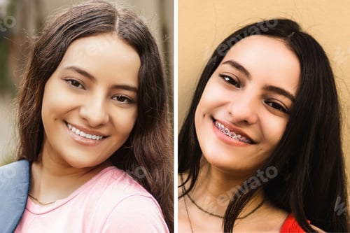 Preview: Before and after comparison of a young Hispanic woman with braces