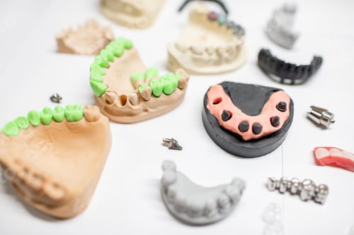 Preview: Artificial jaw models with dental implants
