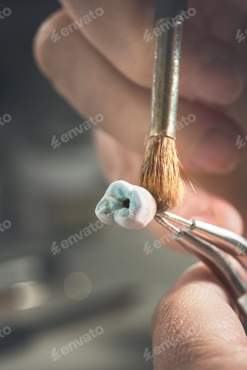 Preview: Dental Prosthesis