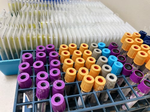 Preview: Blood collection station at the laboratory