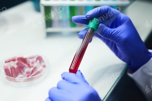 Preview: Blood Test Tube