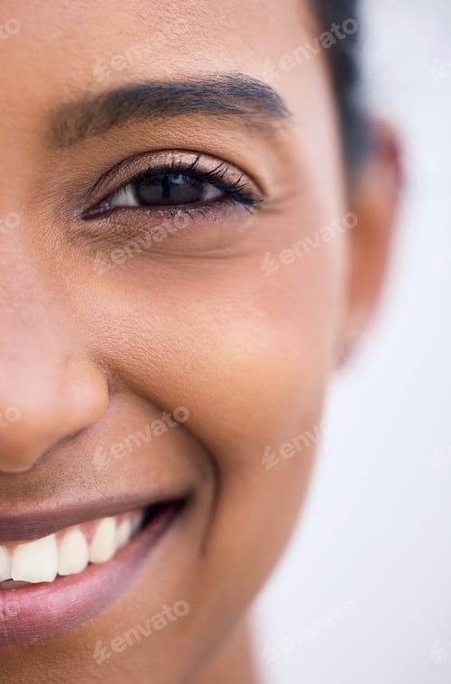 Preview: The perfect smile