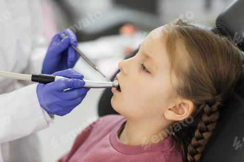 Preview: Girl lying on dentist chair with open mouth, female doctor curing her teeth, using dental drill.