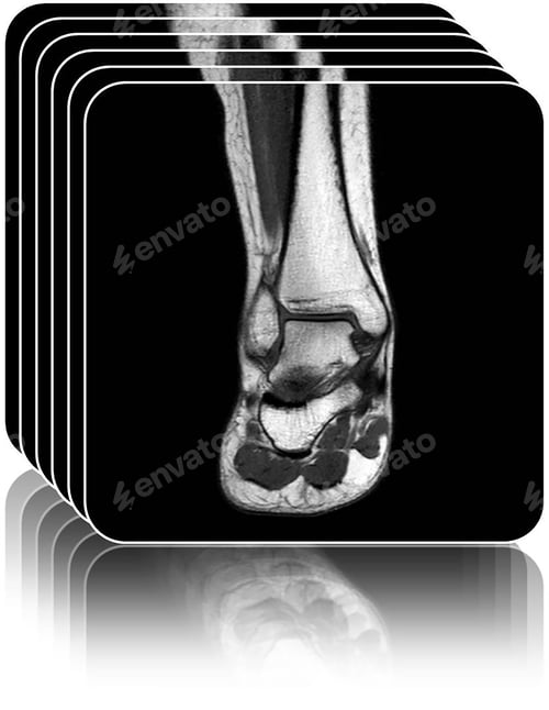 Preview: MRI of the foot and ankle