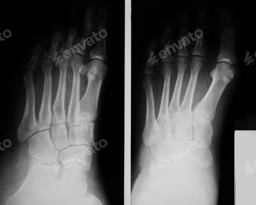 Preview: Details of X Ray Frame from Hospital