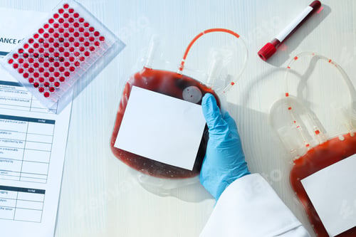 Preview: Bags and test tube with donor blood, documents and gloved hand on light background, top view