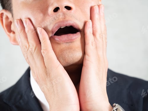 Preview: Male businessmen who regret having beard hair removal