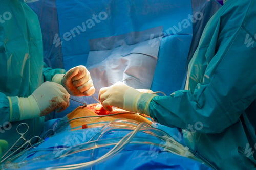 Preview: An operating room in hospital is used by medical team of surgeons to perform open heart surgery on a