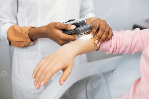Preview: Doctor dermatologist examining birthmarks and moles on a female patient's hand. Close up cropped