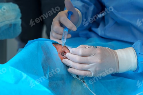 Preview: Surgeon Administering Injection During Eye Surgery Procedure