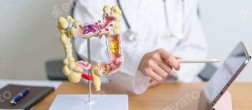 Preview: Doctor with human Colon anatomy model and tablet.
