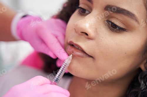 Preview: Lip augmentation procedure performed on the face of young patient
