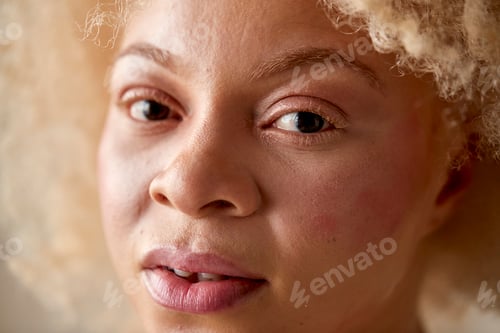 Preview: Studio Portrait Shot Of Confident Natural Albino Woman In Underwear Promoting Body Positivity